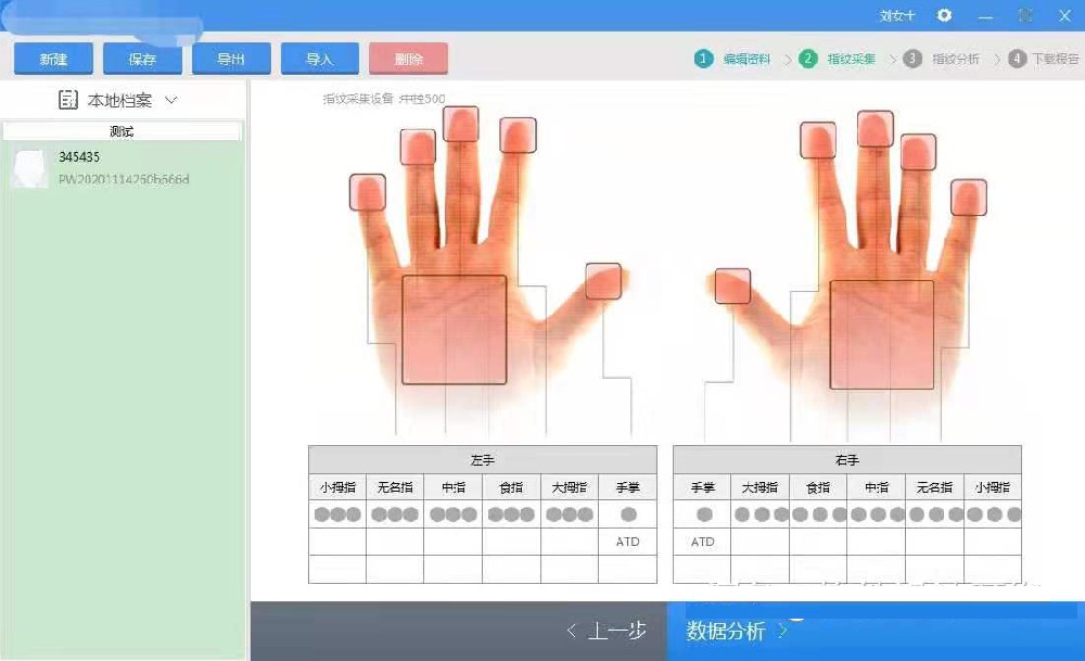 皮紋測試系統,指紋,掌紋采集,報告分析輸出,打印報告,模版等